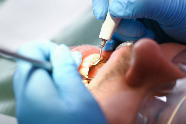 Best Emergency Tooth Extraction  in Cedar Hill, MO